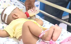 TP.HCM: Cảnh báo bệnh viêm màng não mủ ở trẻ gia tăng