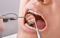 Tác dụng phụ nghiêm trọng nếu uống quá nhiều nước chanh