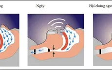 Phát hiện mới ngăn chặn nguy cơ mắc chứng mất trí