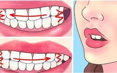 Làm thế nào để không nghiến răng khi ngủ?
