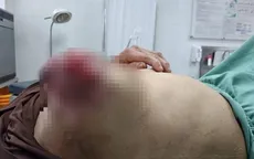 Nguy hiểm: Đắp lá chữa ung thư vú