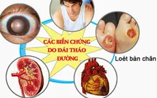 Biến chứng tim mạch ở bệnh nhân đái tháo đường