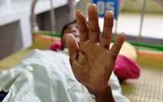 Quảng Ngãi: Thông tin mới về hội chứng viêm da dày sừng bàn tay, bàn chân