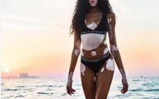 Winnie Harlow khoe dáng thon gọn