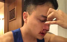 Cao Thái Sơn phải đi cấp cứu lúc nửa đêm vì chảy máu mũi