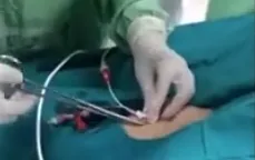 Nghệ An: Cứu sống bệnh nhân sốc tim, sốc nhiễm khuẩn nặng