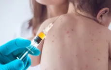 Dịch sởi có nguy cơ bùng phát trở lại tại Mỹ