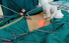Trẻ đau bụng quanh rốn, vào viện phát hiện dị vật kim loại đâm thủng ruột non
