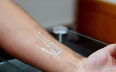 Miếng dán hỗ trợ điều trị bệnh Parkinson