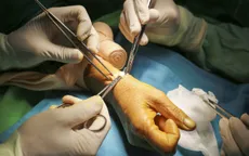 Đừng chủ quan với hội chứng viêm bao gân