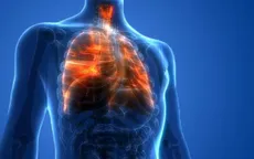 Mỹ đặt tên cho căn bệnh viêm phổi do thuốc lá điện tử gây ra