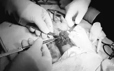 Ngã vào viên gạch vỡ khi đang tắm, bé 6 tuổi bị cứa đứt gân tay