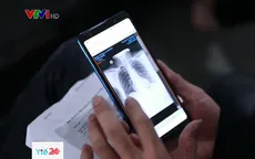 Bệnh viện số hóa hình ảnh phim chụp