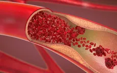 Kỳ lạ người đàn ông bị mất vị giác do thiếu máu