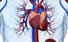 Viêm cơ tim cấp - Một số điều bệnh nhân cần biết