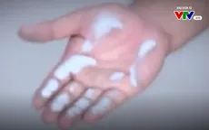 5 cách bảo vệ làn da trong môi trường ô nhiễm