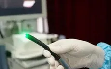 Phương pháp mới nội soi dạ dày