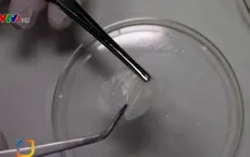 Tạo ra da người trong phòng thí nghiệm