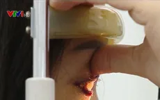 Mù mắt do tiêm filler nâng mũi bởi "bác sĩ rởm" tại hàng sửa móng tay, nối mi