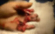 Mắc kẹt bao tay, nam thanh niên bị máy cán tôn cuốn nát bàn tay