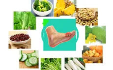 Chế độ ăn uống hợp lý cho người bệnh gout trong những ngày Tết