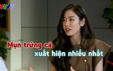 Không thì thầm số 17: Beauty blogger Mai Vân Trang chia sẻ về nỗi ám ảnh về mụn thời đi học