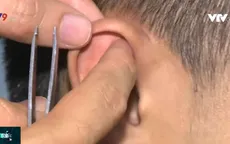 Hiệu quả phương pháp cai nghiện thuốc lá bằng nhĩ châm