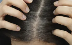 Nhận biết người bệnh tâm thần qua nang tóc