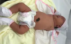 Hiếm gặp: Bé gái chào đời với cân nặng 5,2 kg