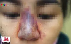 Một phụ nữ ngưng tim, ngưng thở sau khi tiêm thuốc gây mê tại thẩm mỹ viện