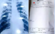 Muốn nghỉ phép dài, giáo viên mua bệnh án mắc lao giả qua mạng