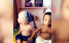 Cặp sinh đôi một da đen, một da trắng hiếm gặp