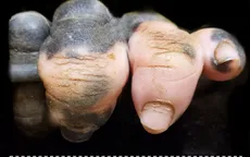 Chú gorilla trở thành ngôi sao mạng xã hội nhờ sở hữu "ngón tay người"