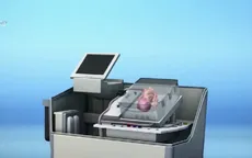 "Hồi sinh" thành công trái tim người đã qua đời