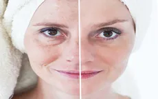 Lợi ích của việc ăn mật ong trước khi ngủ