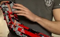 Chàng trai khuyết tật tự lắp ráp cánh tay giả từ đồ chơi lego