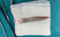 Cứu nam thanh niên bị dao đâm gãy cán nằm trong lồng ngực