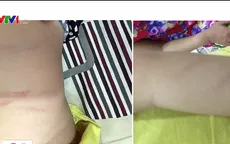 Con 3 tuổi bị cô giáo bạo hành, phụ huynh đòi bồi thường 100 triệu đồng