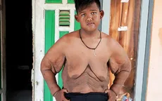 Cậu bé mập nhất thế giới giảm được 106kg