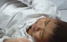 Bé trai 4 tuổi ở Hà Nam bị chó nhà nuôi cắn: Sức khỏe đã ổn định