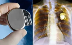 Sắp có máy điều hoà nhịp tim không dùng pin