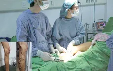 Suy giãn tĩnh mạch chi dưới không còn là mối lo