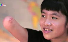 Câu chuyện truyền cảm hứng của cô bé khuyết cánh tay phải