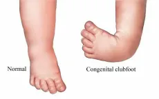 Khám, tư vấn miễn phí cho người bệnh có chỉ định phẫu thuật cổ chân và bàn chân