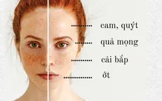 Tìm hiểu chế độ ăn cho từng loại da