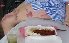 Mua bán axit quá dễ - Một hành vi tiếp tay cho những kẻ thủ ác