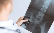 Bệnh viện Chợ Rẫy xác nhận khoan nhầm chân bệnh nhân