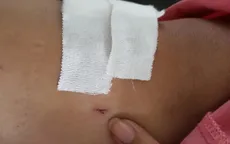Vụ khoan nhầm chân bệnh nhân ở bệnh viện Chợ Rẫy: Đình chỉ 2 nhân viên y tế