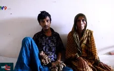 "Người cây" Bangladesh muốn cắt cụt tay chân