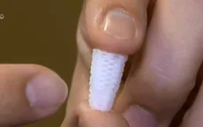 Tiết kiệm thời gian và chi phí điều trị bằng chân răng 3D